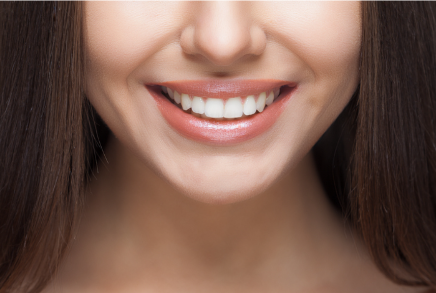 Beyond Aesthetics: How Hollywood Smile Treatment Can Improve Dental Health